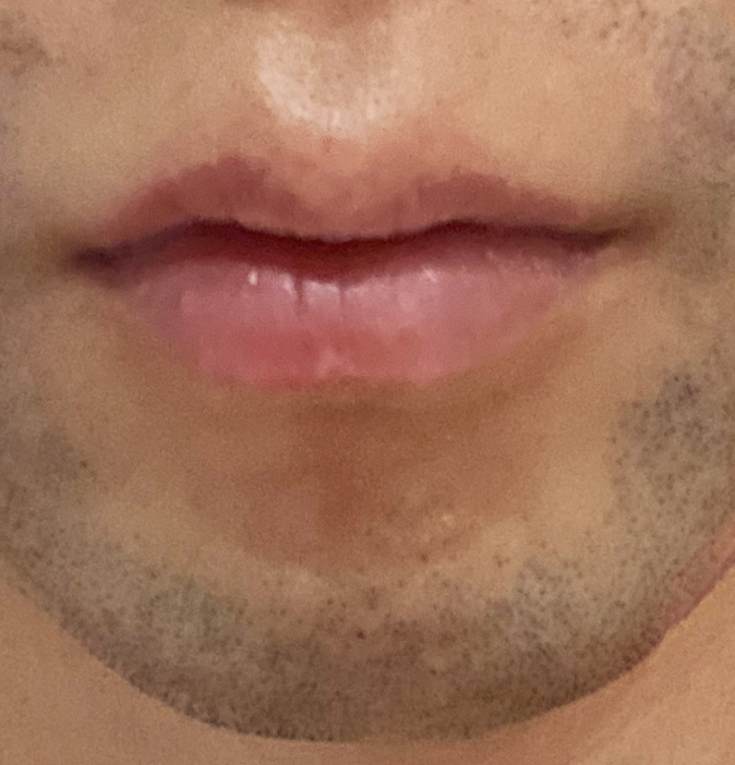 8週間の使用のイメージ