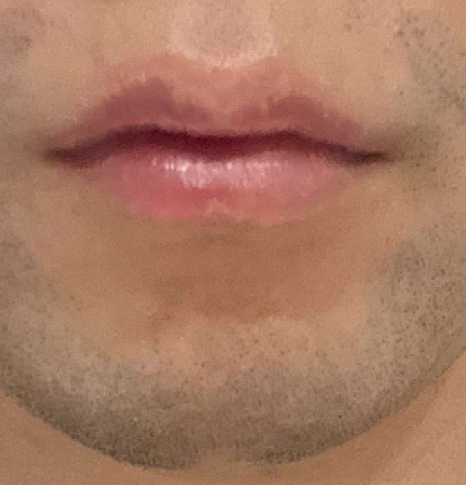 16週間の使用のイメージ