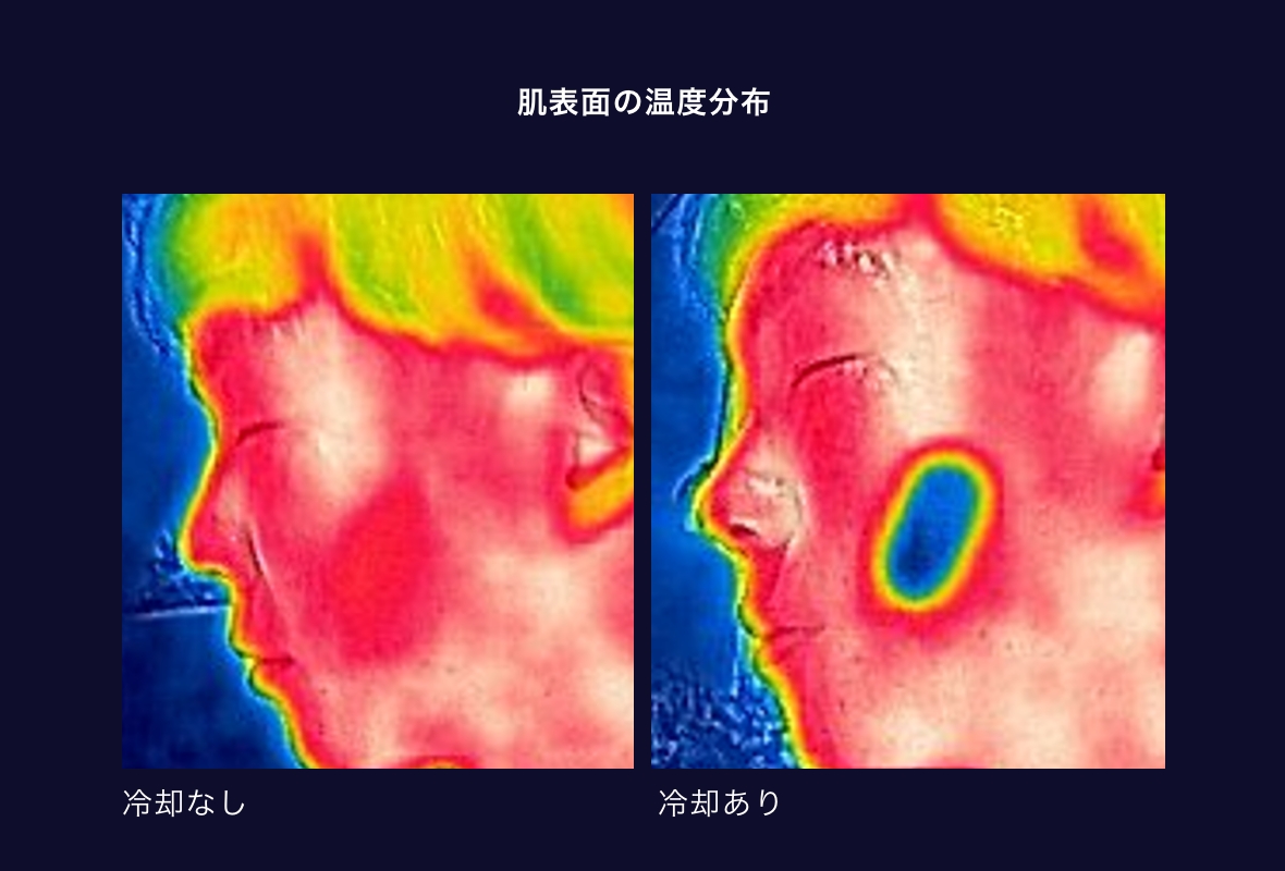 冷却なし/ありイメージ